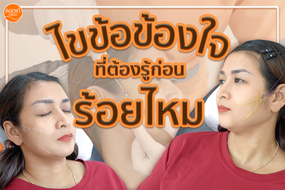 ไขข้อข้องใจการร้อยไหม