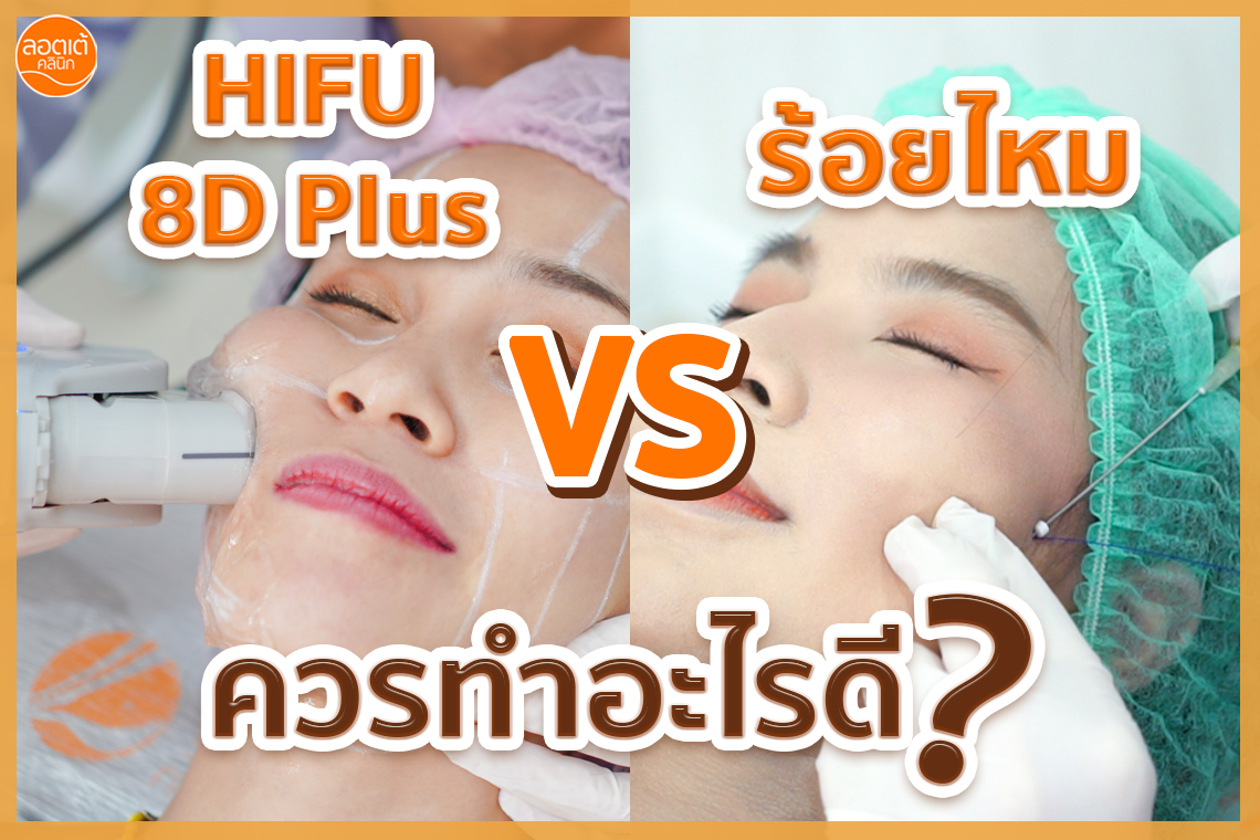 โปรแกรม ร้อยไหม หรือ โปรแกรม HIFU 8D Plus เลือกแบบไหนดี ?