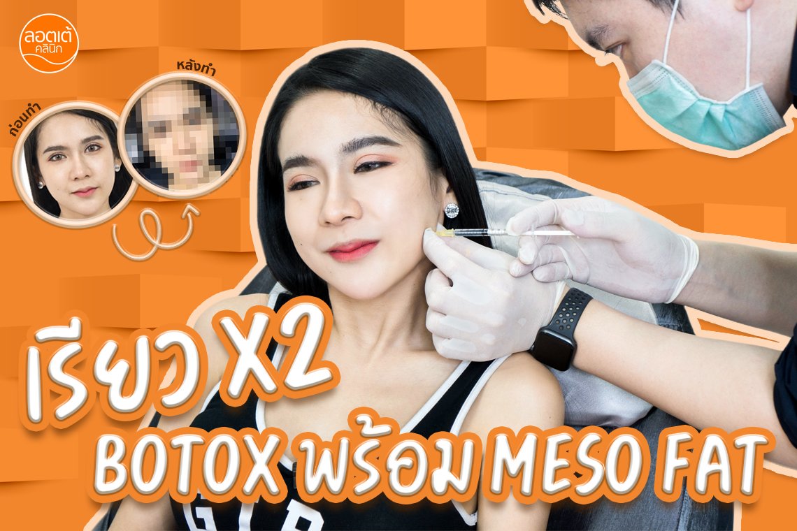 หน้าเรียวเป๊ะมุมไหนก็รอดเลือกโปรแกรม Botox + โปรแกรมสลายไขมัน