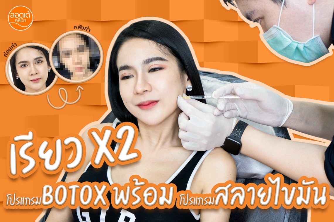 หน้าเรียวเป๊ะมุมไหนก็รอดเลือกโปรแกรม Botox + โปรแกรมสลายไขมัน