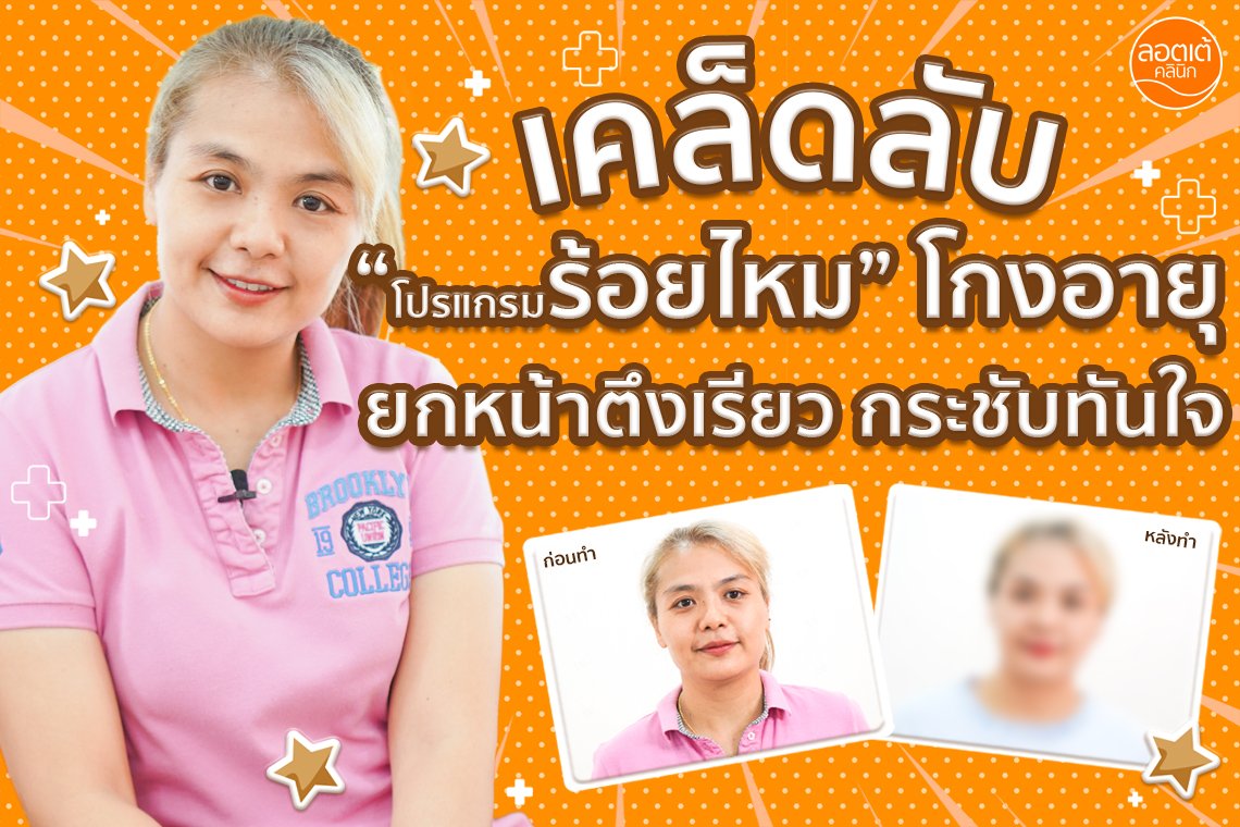 เคล็ดลับ "โปรแกรมร้อยไหม" โกงอายุยกหน้าตึงเรียวกระชับทันใจ เคล็ดลับ "โปรแกรมร้อยไหม" โกงอายุยกหน้าตึงเรียวกระชับทันใจ