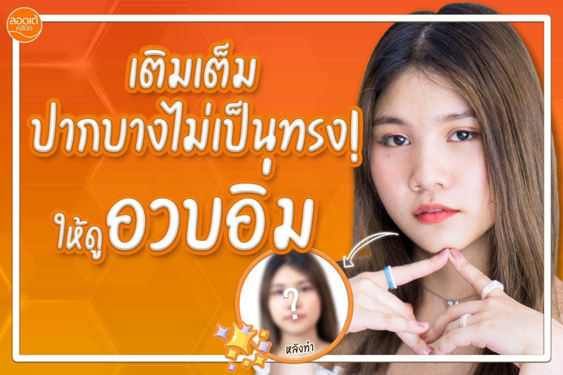เติมเต็มปากบางไม่เป็นทรงให้ดูอวบอิ่มด้วยโปรแกรม Filler เติมเต็มปากบางไม่เป็นทรงให้ดูอวบอิ่มด้วยโปรแกรม Filler