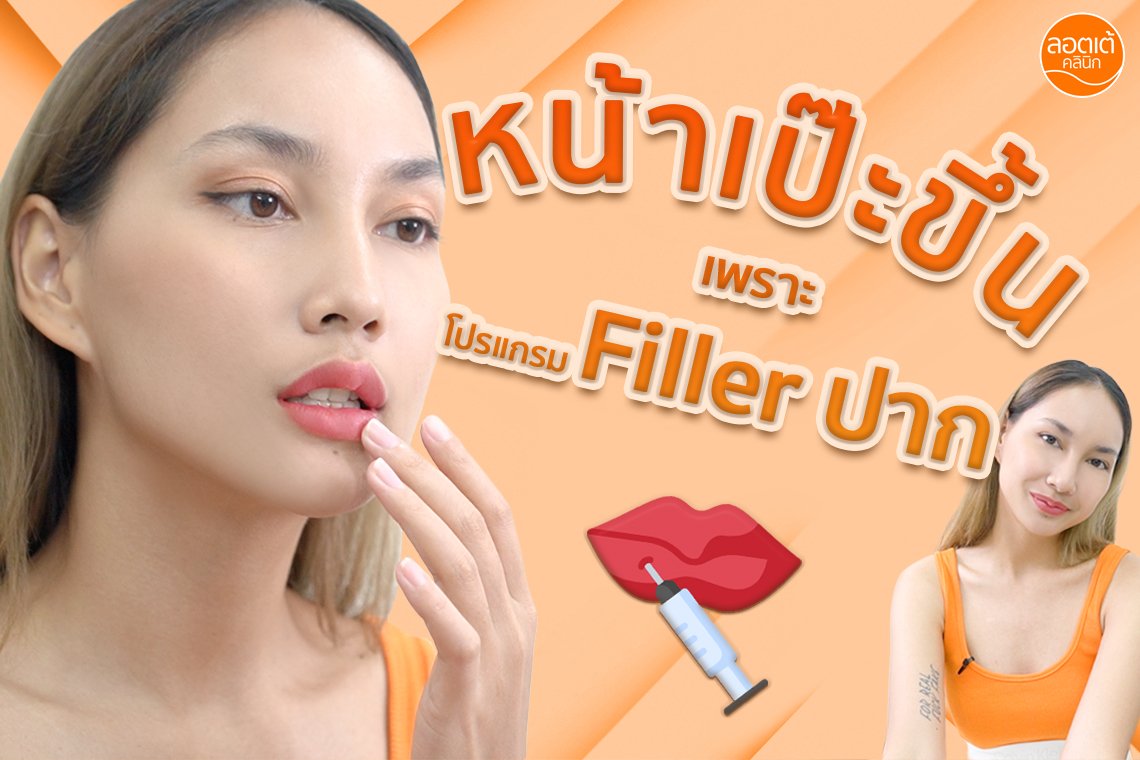 หน้าเป๊ะขึ้น เพราะโปรแกรม Filler ปาก หน้าเป๊ะขึ้น เพราะโปรแกรม Filler ปาก