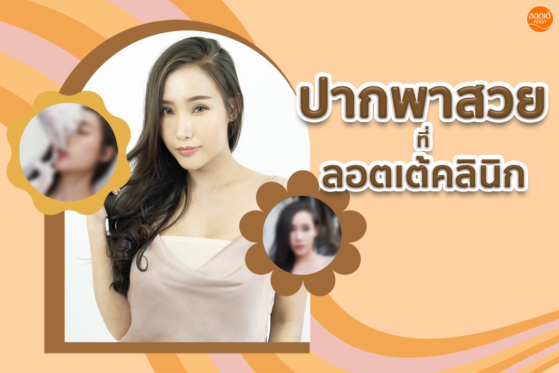 ปากพาสวย กับลอตเต้คลินิก ปากพาสวย กับลอตเต้คลินิก