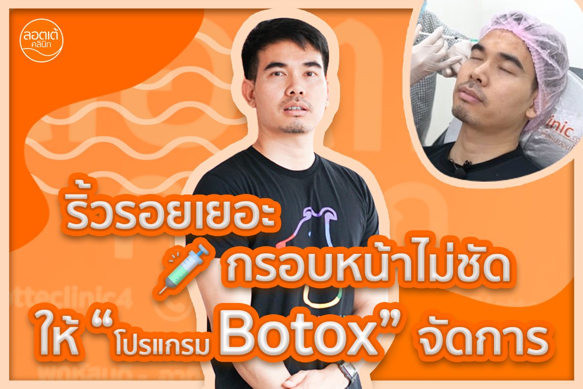 ริ้วรอยเยอะ กรอบหน้าไม่ชัด จัดโปรแกรม Botox ไปเลยสิครับบ