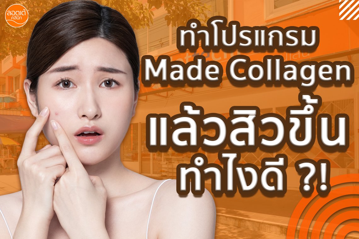 ทำโปรแกรม Made Collagen แล้วสิวขึ้น ทำไงดี ?! ทำโปรแกรม Made Collagen แล้วสิวขึ้น ทำไงดี ?!