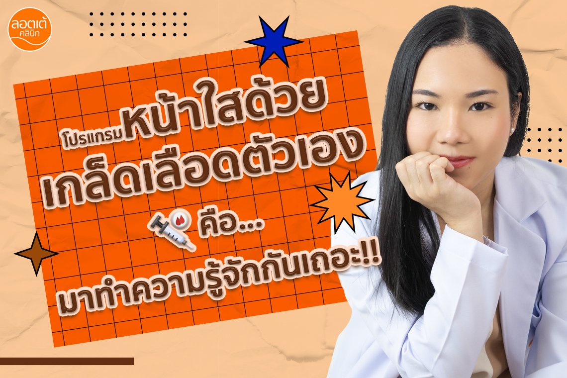 มาทำความรู้จักกับ "โปรแกรมหน้าใสด้วยเกล็ดเลือดตัวเอง" กันเถอะ!!