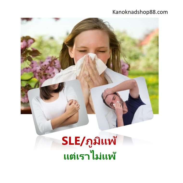   SLE/ ภูมิแพ้