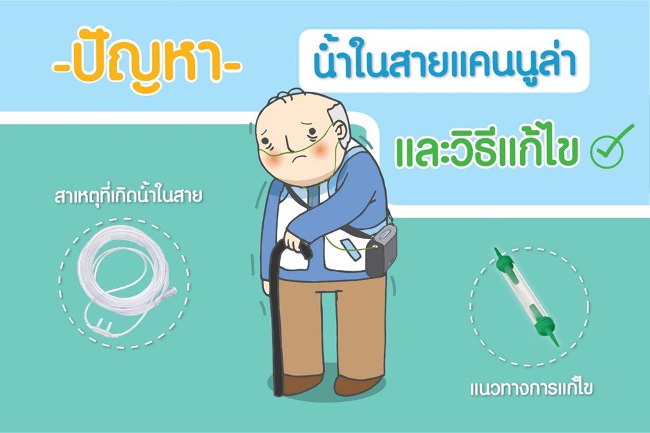 เกิดน้ำในสายออกซิเจน(แคนนูล่า) จะแก้ไขยังไง? เกิดน้ำในสายออกซิเจน(แคนนูล่า) จะแก้ไขยังไง?