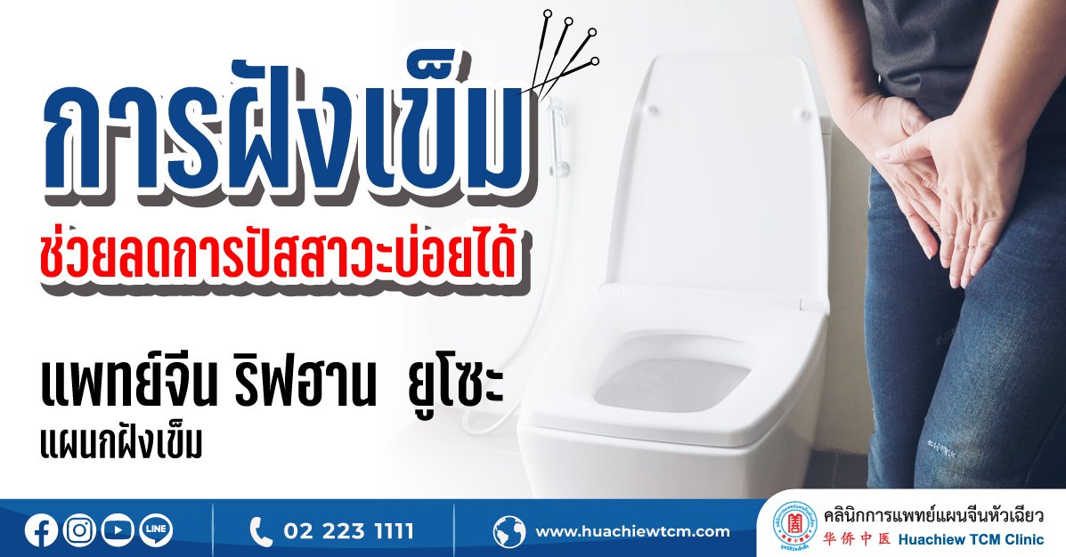 การฝังเข็มช่วยลดการปัสสาวะบ่อยได้ การฝังเข็มช่วยลดการปัสสาวะบ่อยได้