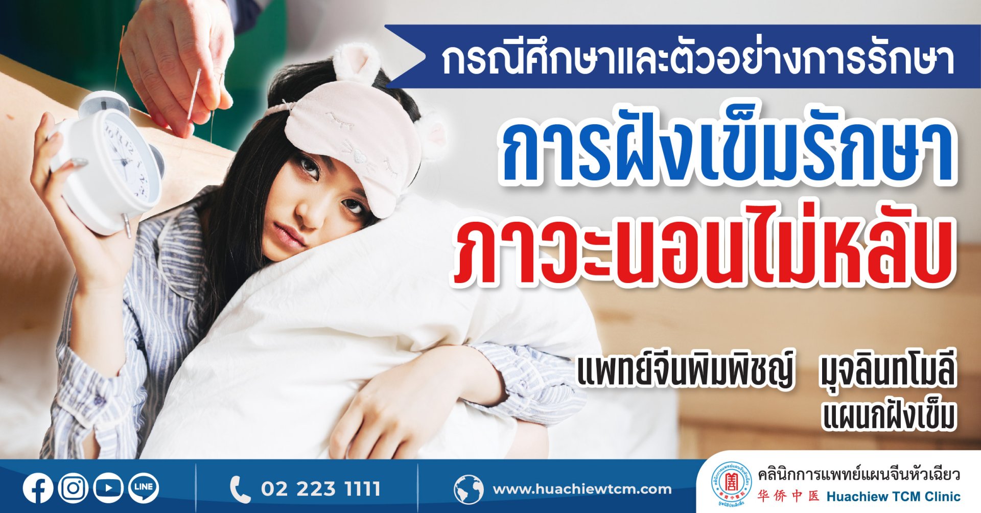 กรณีศึกษาการฝังเข็มรักษาภาวะนอนไม่หลับ กรณีศึกษาการฝังเข็มรักษาภาวะนอนไม่หลับ