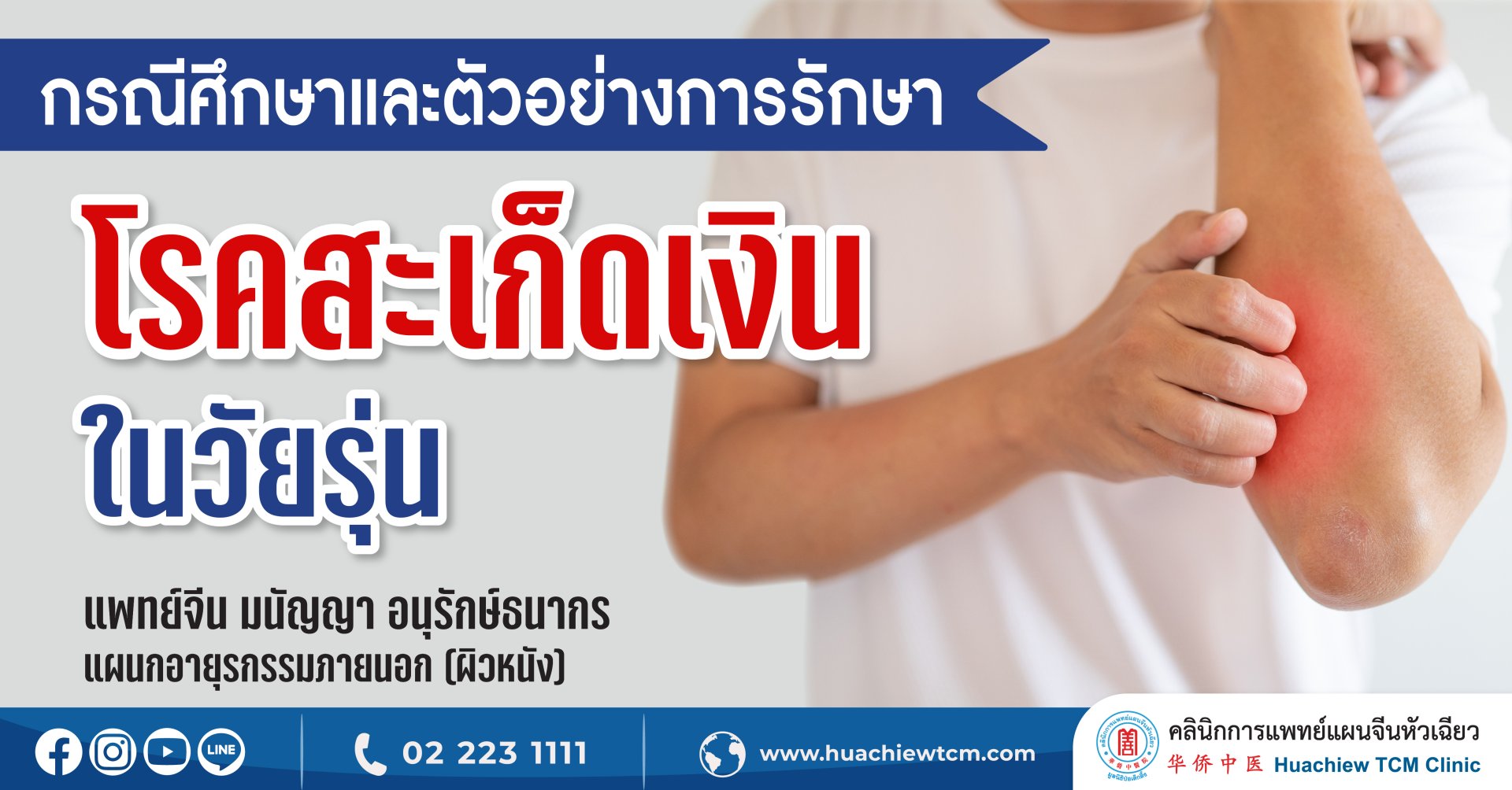 ตัวอย่างการรักษาสะเก็ดเงินในวัยรุ่นด้วยการแพทย์แผนจีน ตัวอย่างการรักษาสะเก็ดเงินในวัยรุ่นด้วยการแพทย์แผนจีน