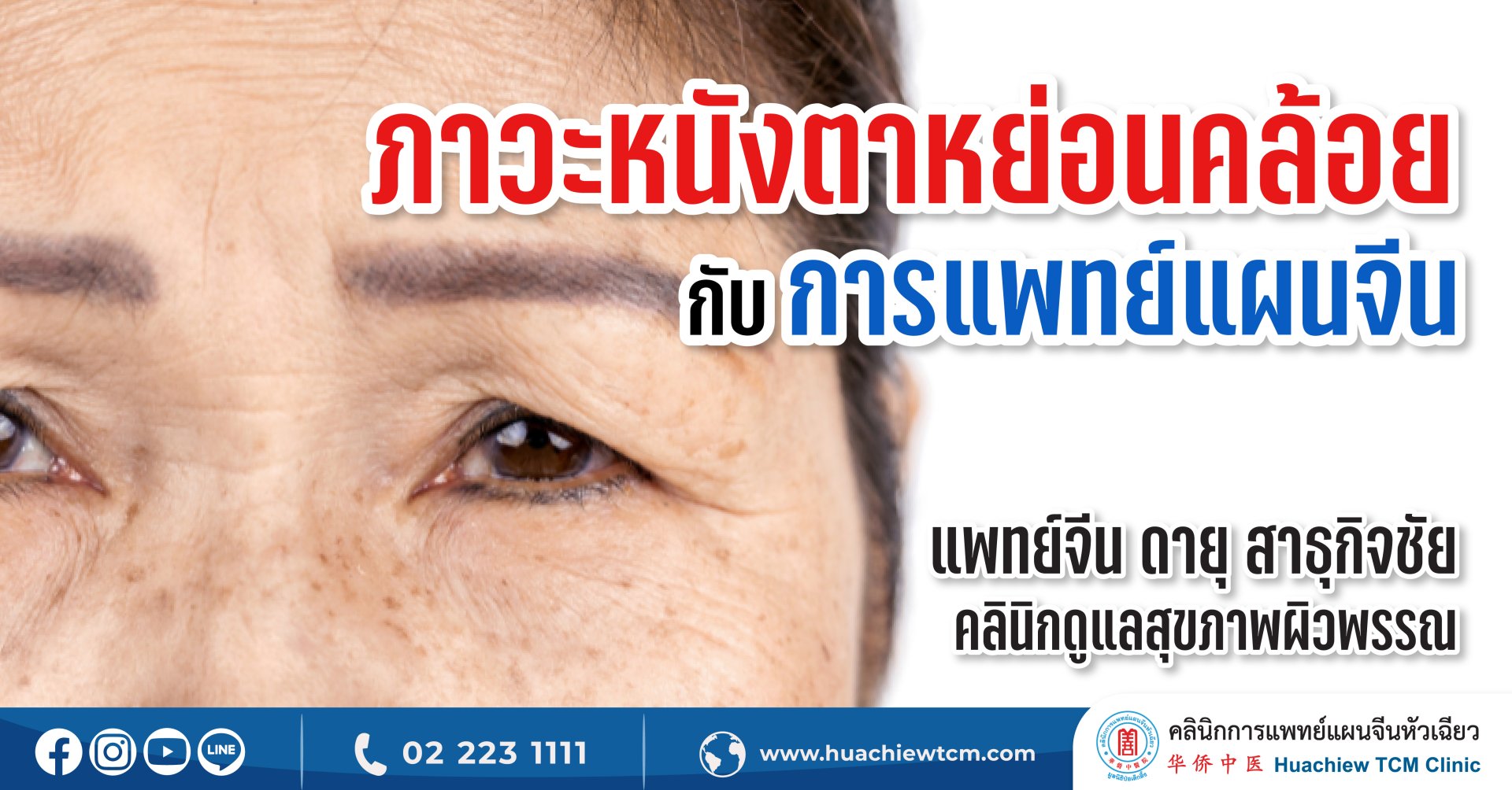 ภาวะหนังตาหย่อนคล้อย ในศาสตร์การแพทย์แผนจีน ภาวะหนังตาหย่อนคล้อย ในศาสตร์การแพทย์แผนจีน