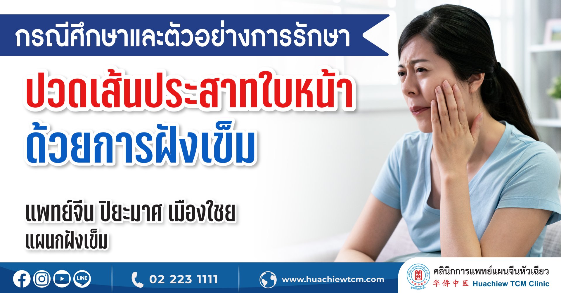 ตัวอย่างการรักษาเคสปวดเส้นประสาทใบหน้าด้วยการฝังเข็ม ตัวอย่างการรักษาเคสปวดเส้นประสาทใบหน้าด้วยการฝังเข็ม