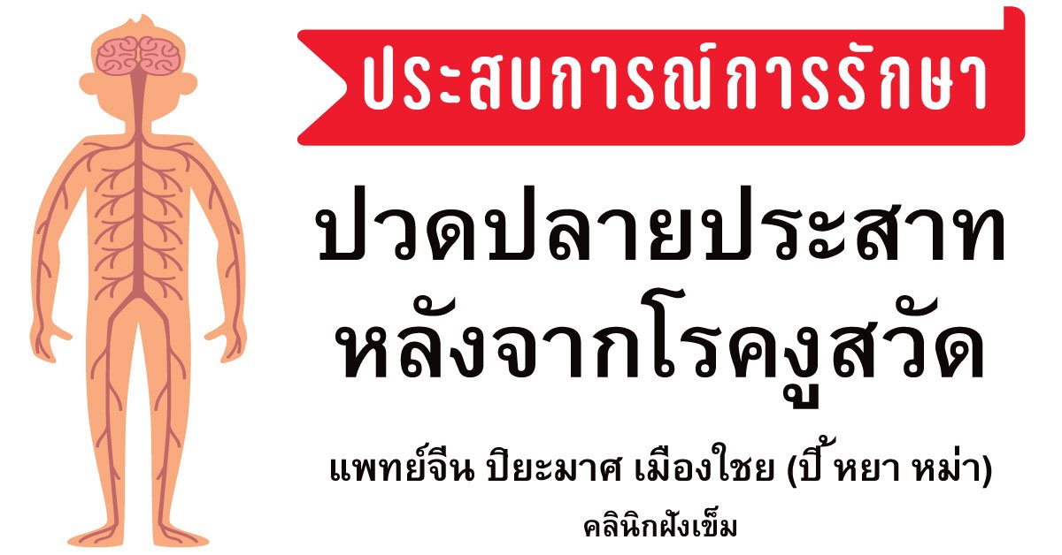 ปวดปลายประสาทหลังจากงูสวัดด้วยการฝังเข็ม (ประสบการณ์การรักษา) ปวดปลายประสาทหลังจากงูสวัดด้วยการฝังเข็ม (ประสบการณ์การรักษา)