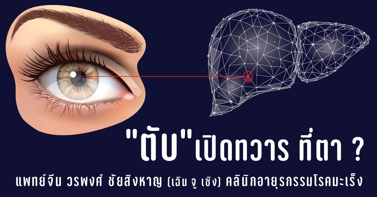 "ตับ" เปิดทวารที่ "ตา" จริงหรือ ? "ตับ" เปิดทวารที่ "ตา" จริงหรือ ?