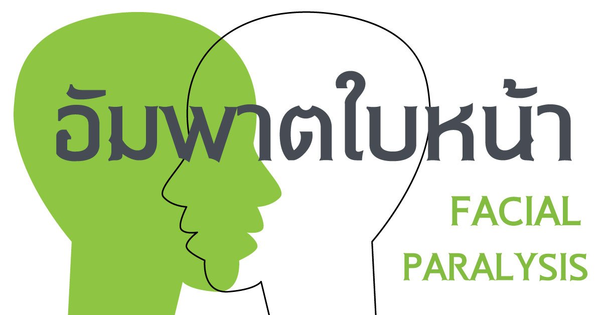 อัมพาตใบหน้า Bell’s palsy อัมพาตใบหน้า Bell’s palsy