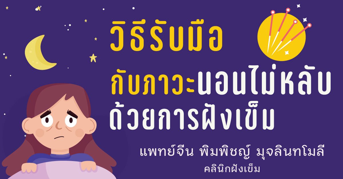 รับมือกับภาวะนอนไม่หลับด้วยการฝังเข็ม รับมือกับภาวะนอนไม่หลับด้วยการฝังเข็ม