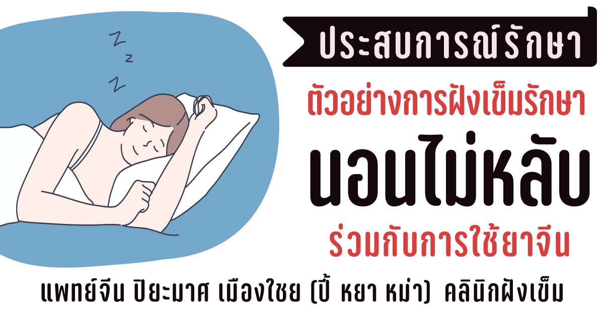 นอนไม่หลับ รักษาด้วยวิธีฝังเข็มและยาจีน (ประสบการณ์การรักษา) นอนไม่หลับ รักษาด้วยวิธีฝังเข็มและยาจีน (ประสบการณ์การรักษา)