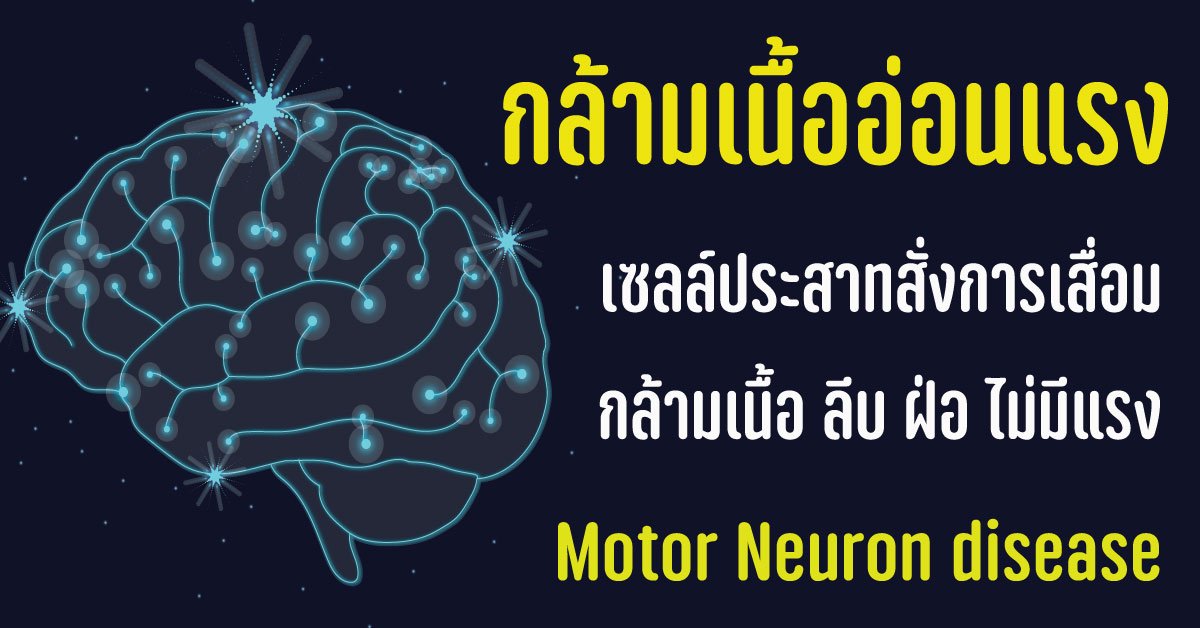 กล้ามเนื้ออ่อนแรง อัมพาตเฉียบพลัน Motor Neuron disease กล้ามเนื้ออ่อนแรง อัมพาตเฉียบพลัน Motor Neuron disease