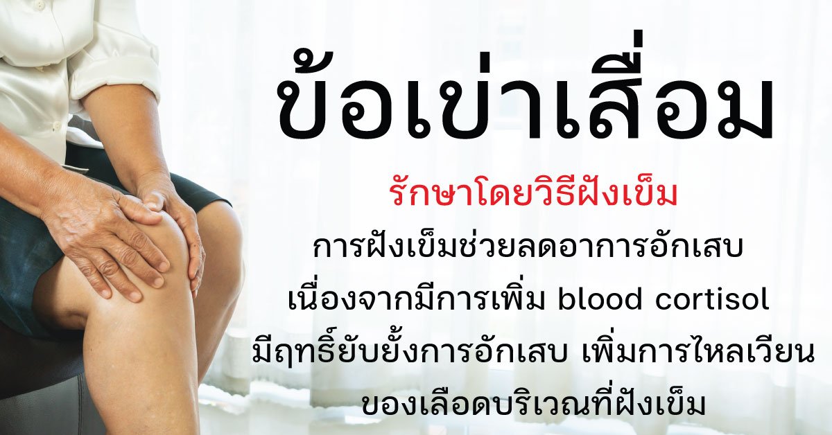 โรคข้อเข่าเสื่อม Osteoarthritis of the knee  OA โรคข้อเข่าเสื่อม Osteoarthritis of the knee  OA