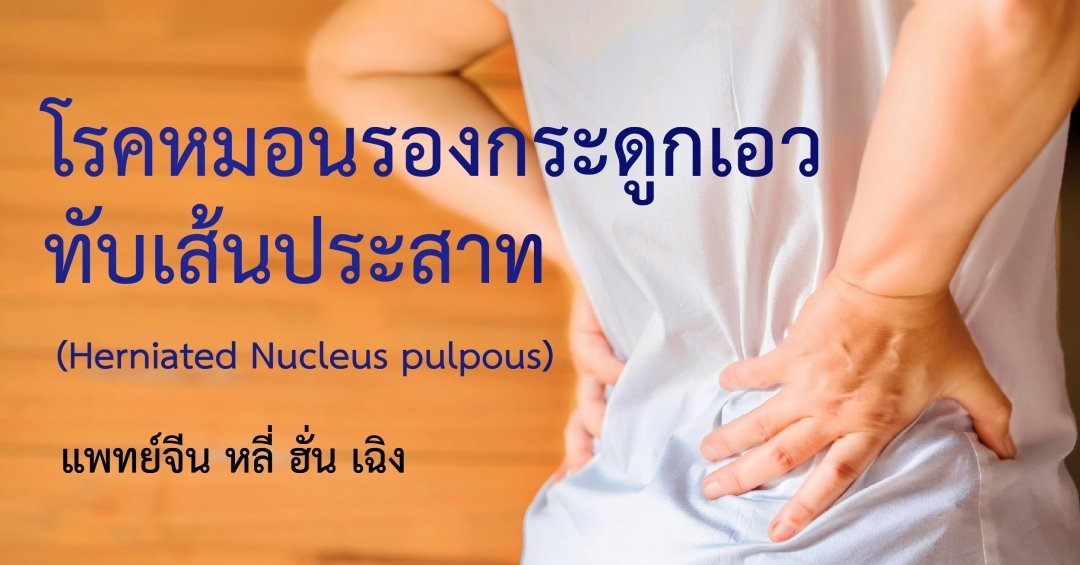 โรคหมอนรองกระดูกเอวทับเส้นประสาท (Herniated Nucleus pulpous) โรคหมอนรองกระดูกเอวทับเส้นประสาท (Herniated Nucleus pulpous)