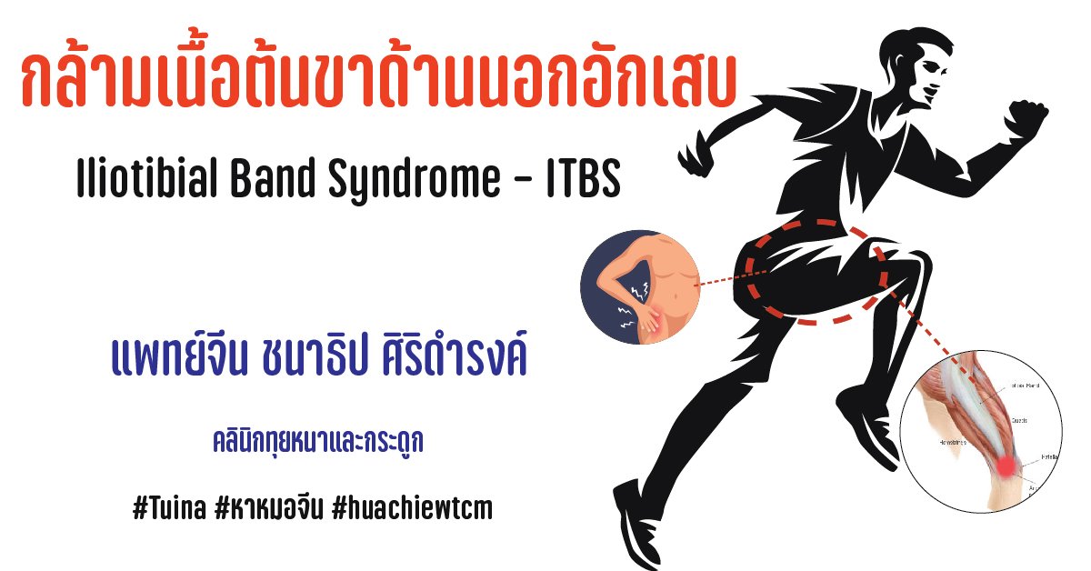 โรคกล้ามเนื้อต้นขาด้านนอกอักเสบ Iliotibial Band Syndrome – ITBS  โรคกล้ามเนื้อต้นขาด้านนอกอักเสบ Iliotibial Band Syndrome – ITBS