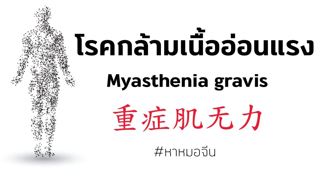 โรคกล้ามเนื้ออ่อนแรง MG  โรคกล้ามเนื้ออ่อนแรง MG