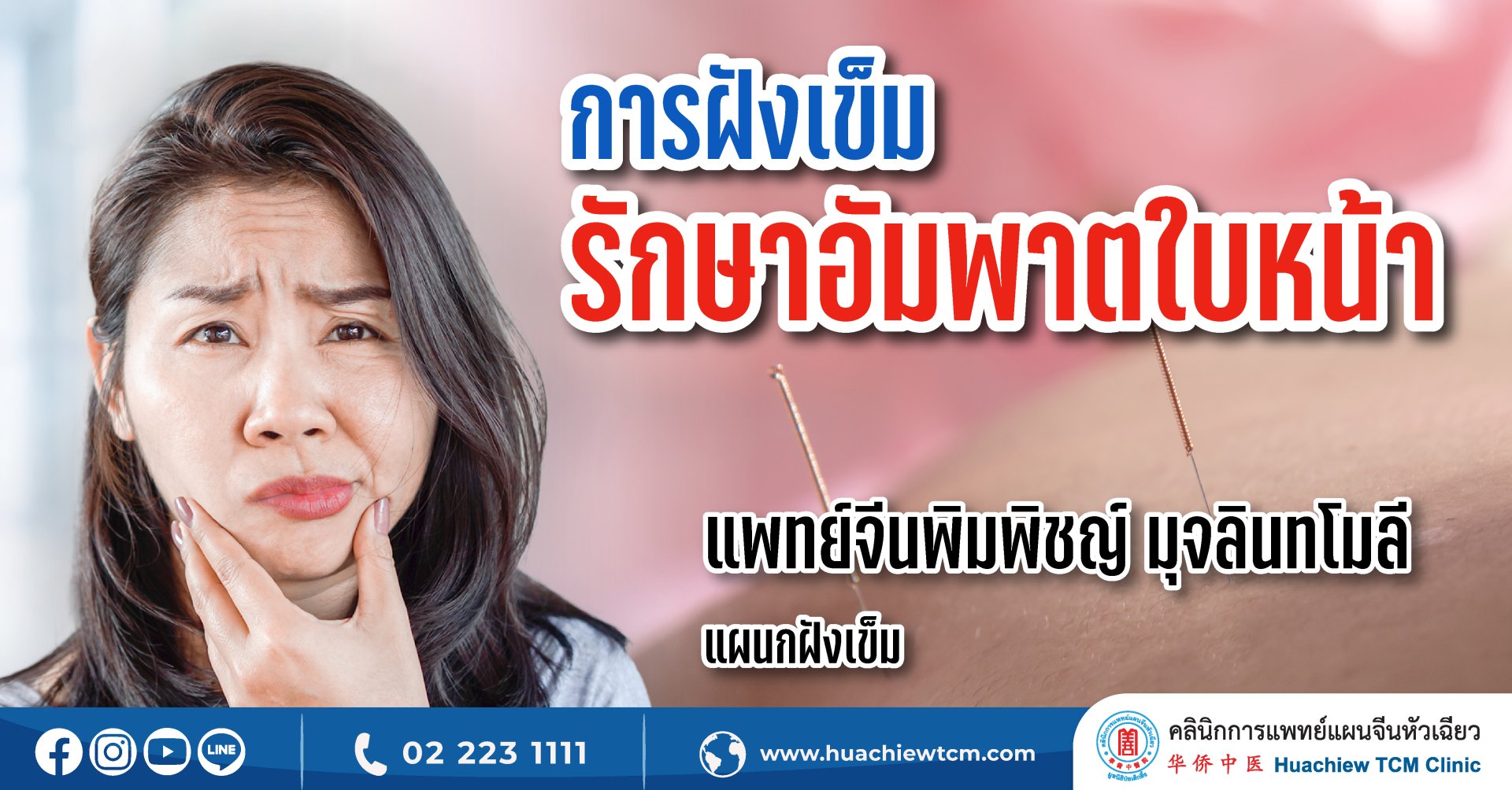 การฝังเข็มรักษาอัมพาตใบหน้า การฝังเข็มรักษาอัมพาตใบหน้า