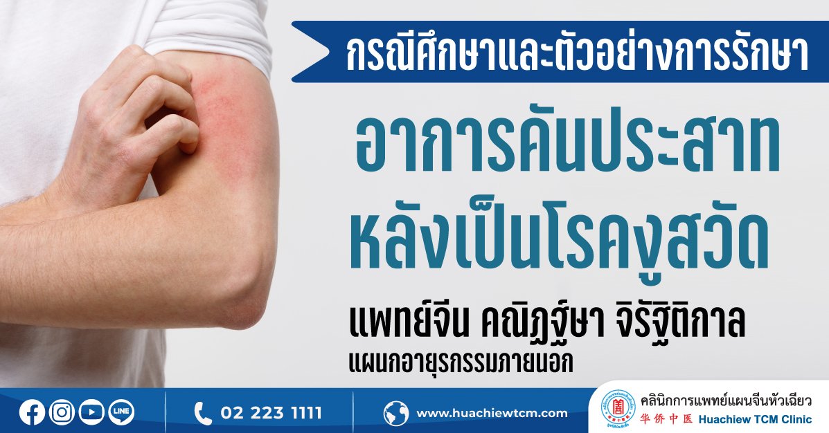 ตัวอย่างกรณีการรักษาผู้ป่วยมีอาการคันประสาทหลังเป็นโรคงูสวัด  ตัวอย่างกรณีการรักษาผู้ป่วยมีอาการคันประสาทหลังเป็นโรคงูสวัด