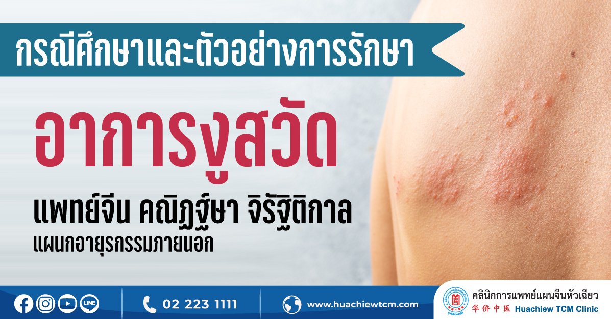 ตัวอย่างกรณีการรักษาผู้ป่วยงูสวัด ตัวอย่างกรณีการรักษาผู้ป่วยงูสวัด