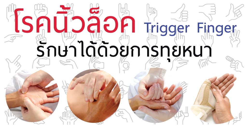 นวดทุยหนารักษาโรคนิ้วล็อค Trigger Finger นวดทุยหนารักษาโรคนิ้วล็อค Trigger Finger