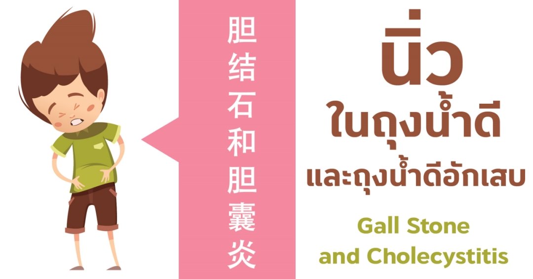 นิ่วในถุงน้ำดี และถุงน้ำดีอักเสบ Gall Stone and Cholecystitis 胆结石和胆囊炎  นิ่วในถุงน้ำดี และถุงน้ำดีอักเสบ Gall Stone and Cholecystitis 胆结石和胆囊炎