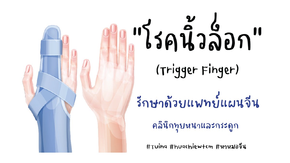 โรคนิ้วล็อก Trigger Finger โรคนิ้วล็อก Trigger Finger