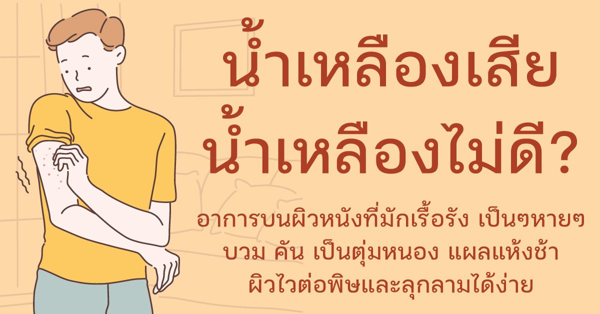 น้ำเหลืองไม่ดี หรือ น้ำเหลืองเสีย คืออะไร? น้ำเหลืองไม่ดี หรือ น้ำเหลืองเสีย คืออะไร?