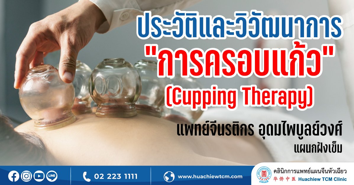 ประวัติและวิวัฒนาการ "การครอบแก้ว (Cupping Therapy)"