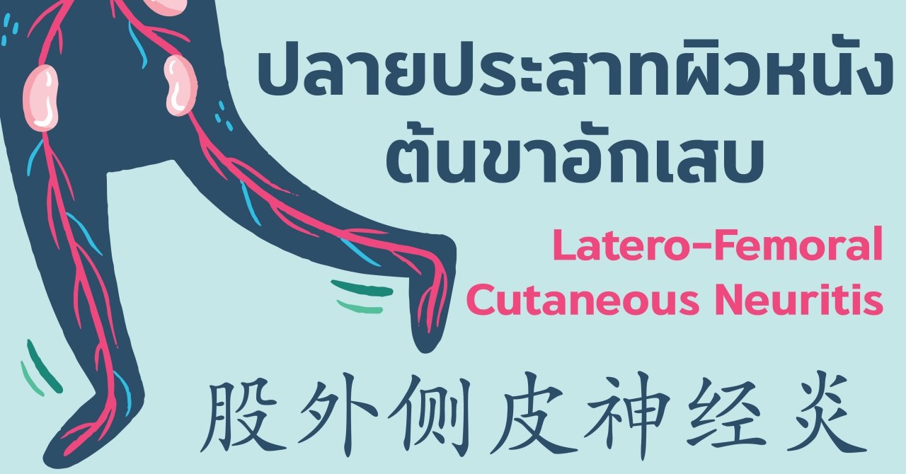 ปลายประสาทผิวหนังต้นขาอักเสบ ปลายประสาทผิวหนังต้นขาอักเสบ
