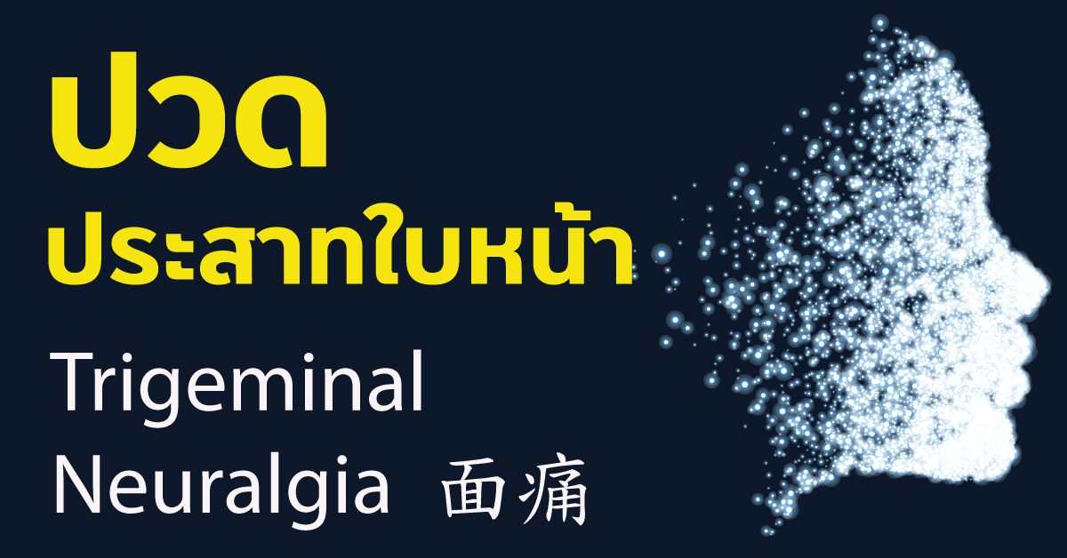 ปวดประสาทใบหน้า Trigeminal Neuralgia  面痛 ปวดประสาทใบหน้า Trigeminal Neuralgia  面痛