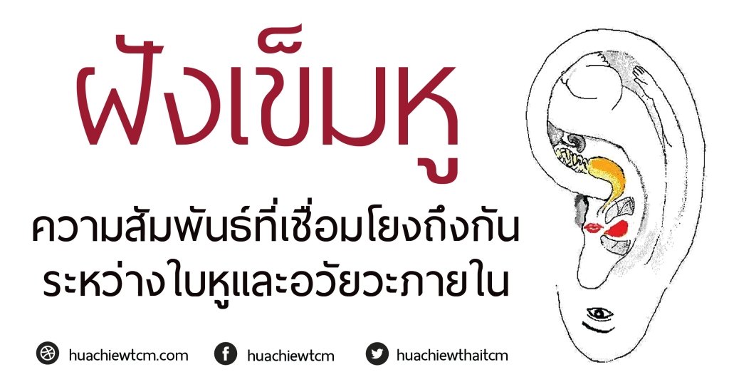 การฝังเข็มหู  Ear Acupuncture Therapy การฝังเข็มหู  Ear Acupuncture Therapy