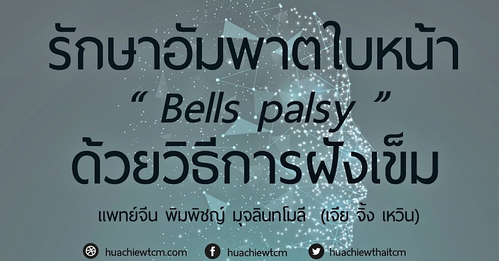 รักษาโรคอัมพาตใบหน้า Bells Palsy ด้วยการฝังเข็ม รักษาโรคอัมพาตใบหน้า Bells Palsy ด้วยการฝังเข็ม
