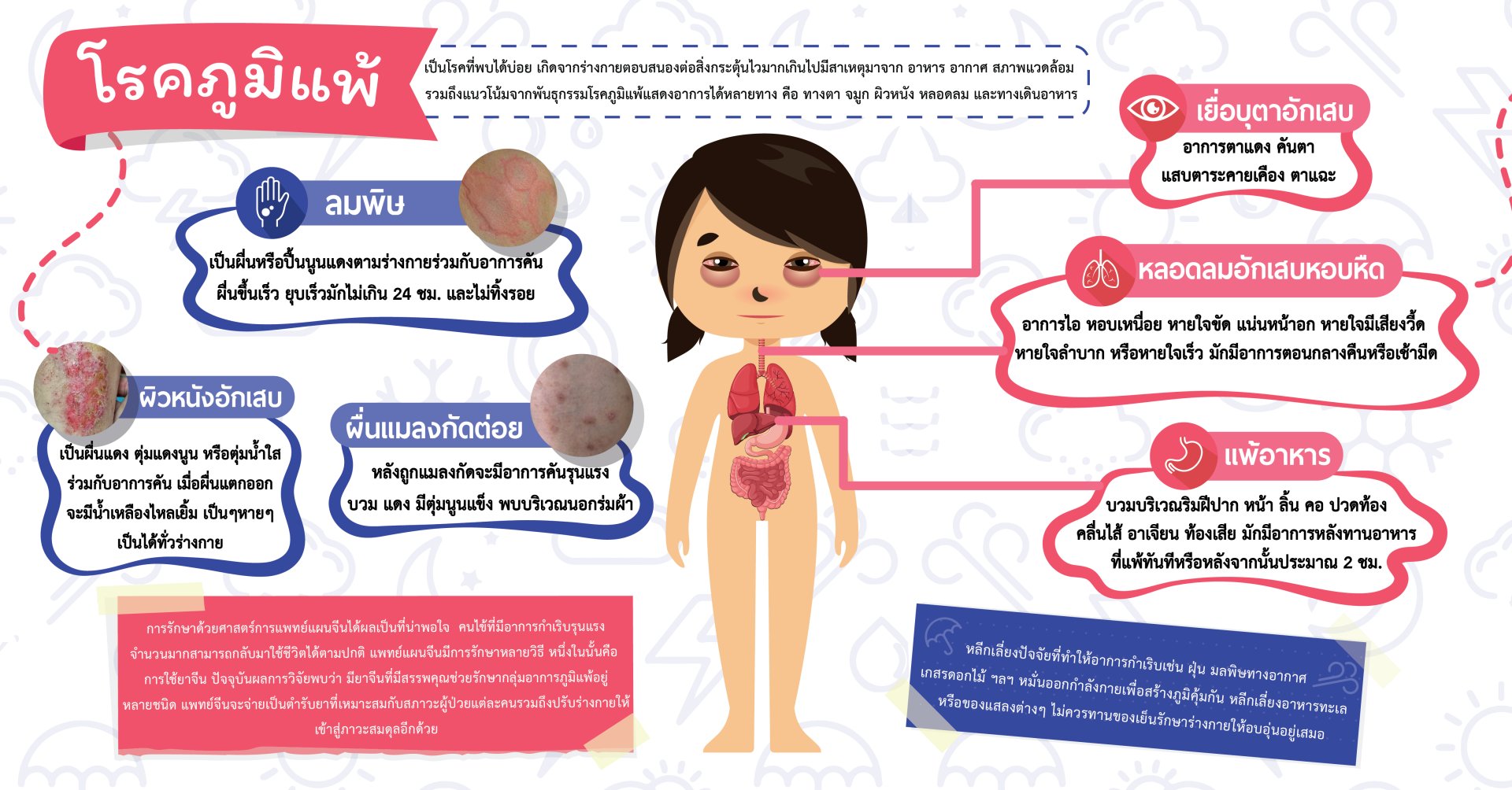 โรคภูมิแพ้  (The allergy) โรคภูมิแพ้  (The allergy)