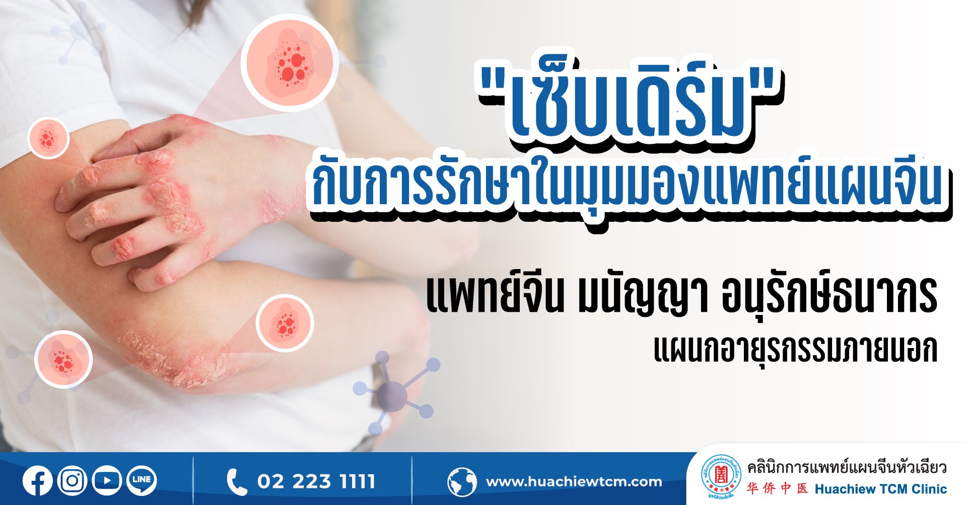“เซ็บเดิร์ม” กับการรักษาในมุมมองแพทย์แผนจีน “เซ็บเดิร์ม” กับการรักษาในมุมมองแพทย์แผนจีน