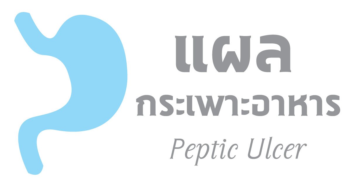 แผลในกระเพาะอาหาร แผลในกระเพาะอาหาร