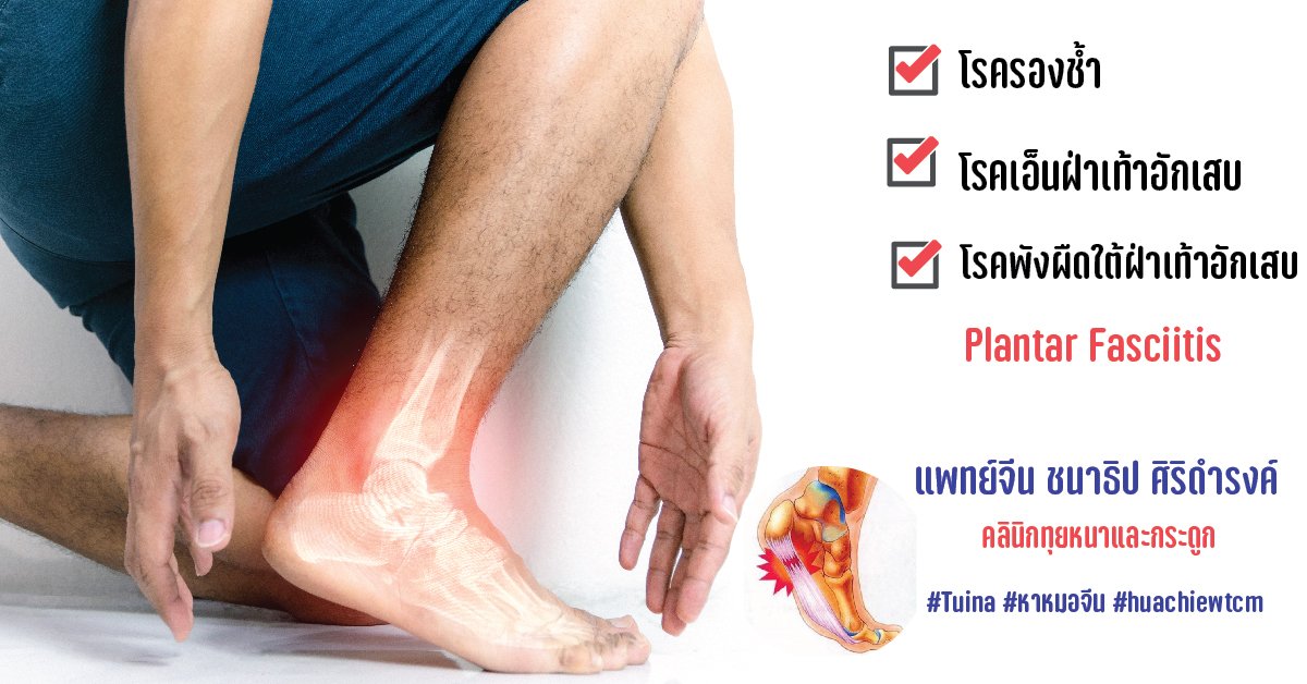 โรครองช้ำ, โรคเอ็นฝ่าเท้าอักเสบ, โรคพังผืดใต้ฝ่าเท้าอักเสบ Plantar fasciitis โรครองช้ำ, โรคเอ็นฝ่าเท้าอักเสบ, โรคพังผืดใต้ฝ่าเท้าอักเสบ Plantar fasciitis