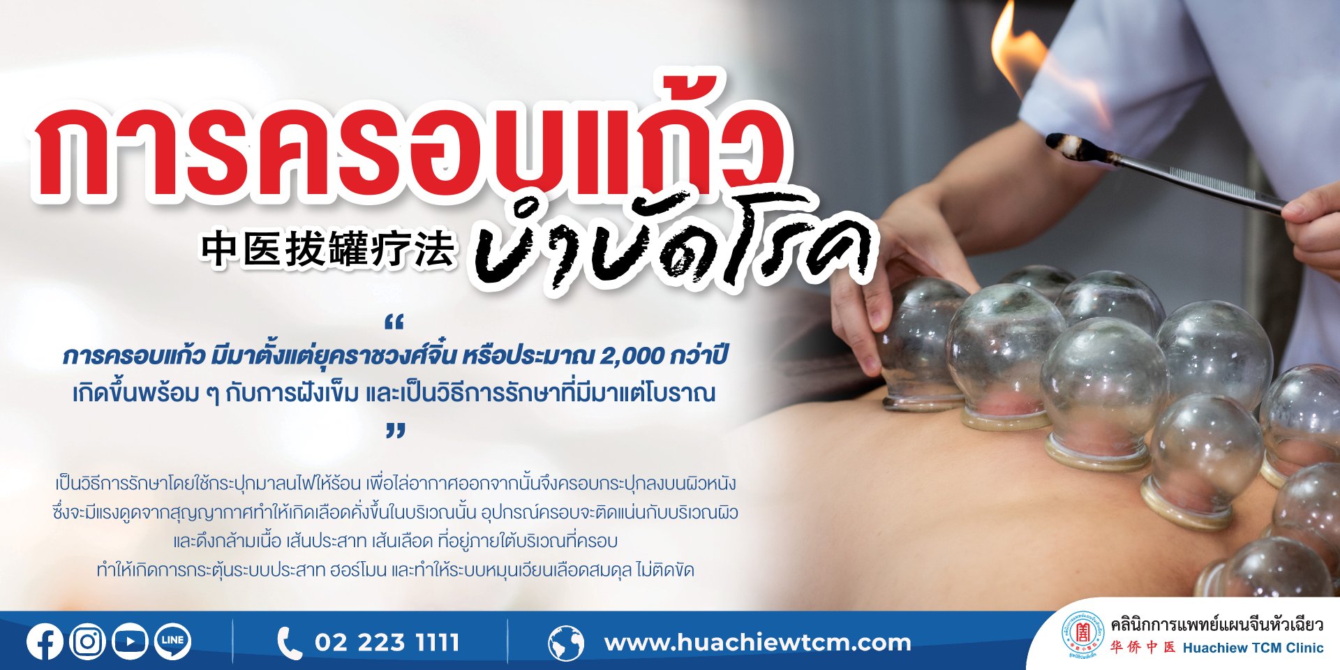 การครอบแก้ว ครอบกระปุก (Cupping Therapy) การครอบแก้ว ครอบกระปุก (Cupping Therapy)