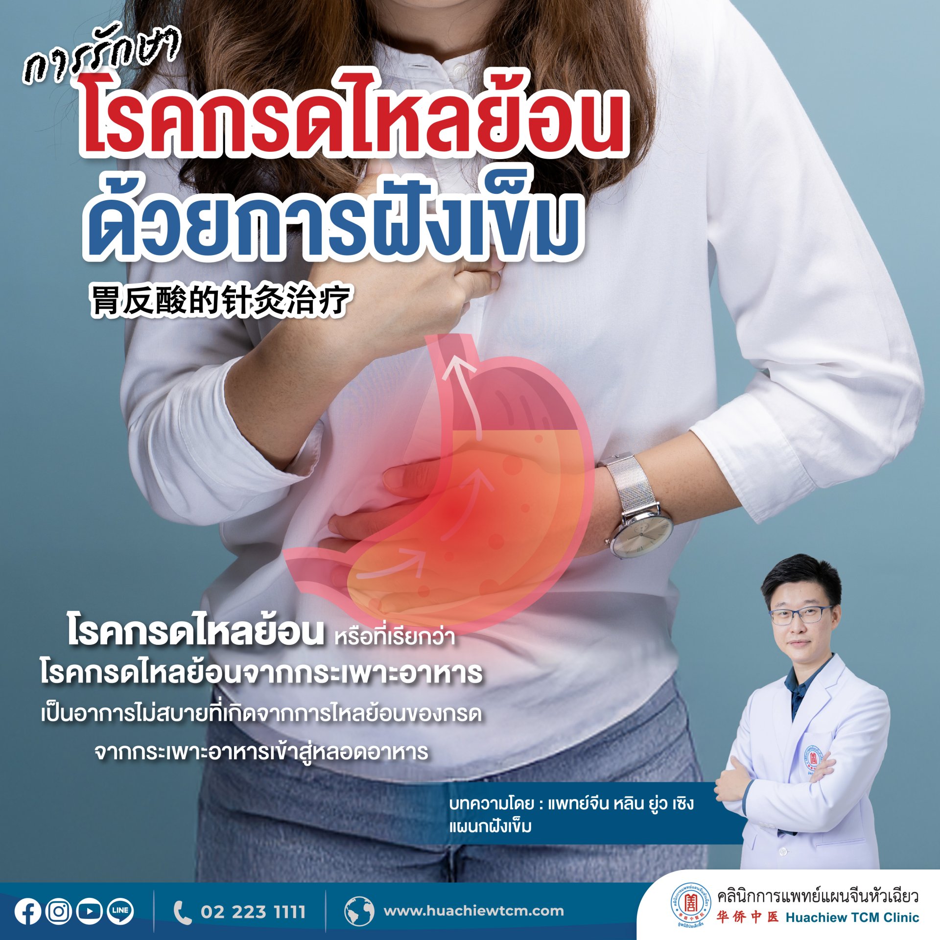 การรักษาโรคกรดไหลย้อนด้วยการฝังเข็ม การรักษาโรคกรดไหลย้อนด้วยการฝังเข็ม