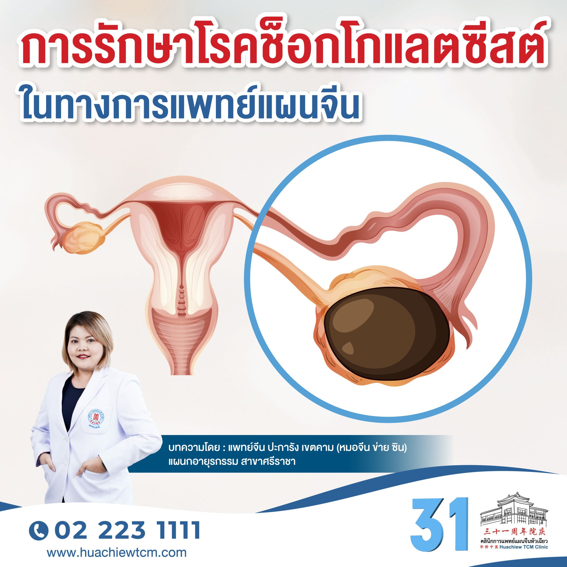 การรักษาโรคช็อกโกแลตซีสต์ในทางการแพทย์แผนจีน
