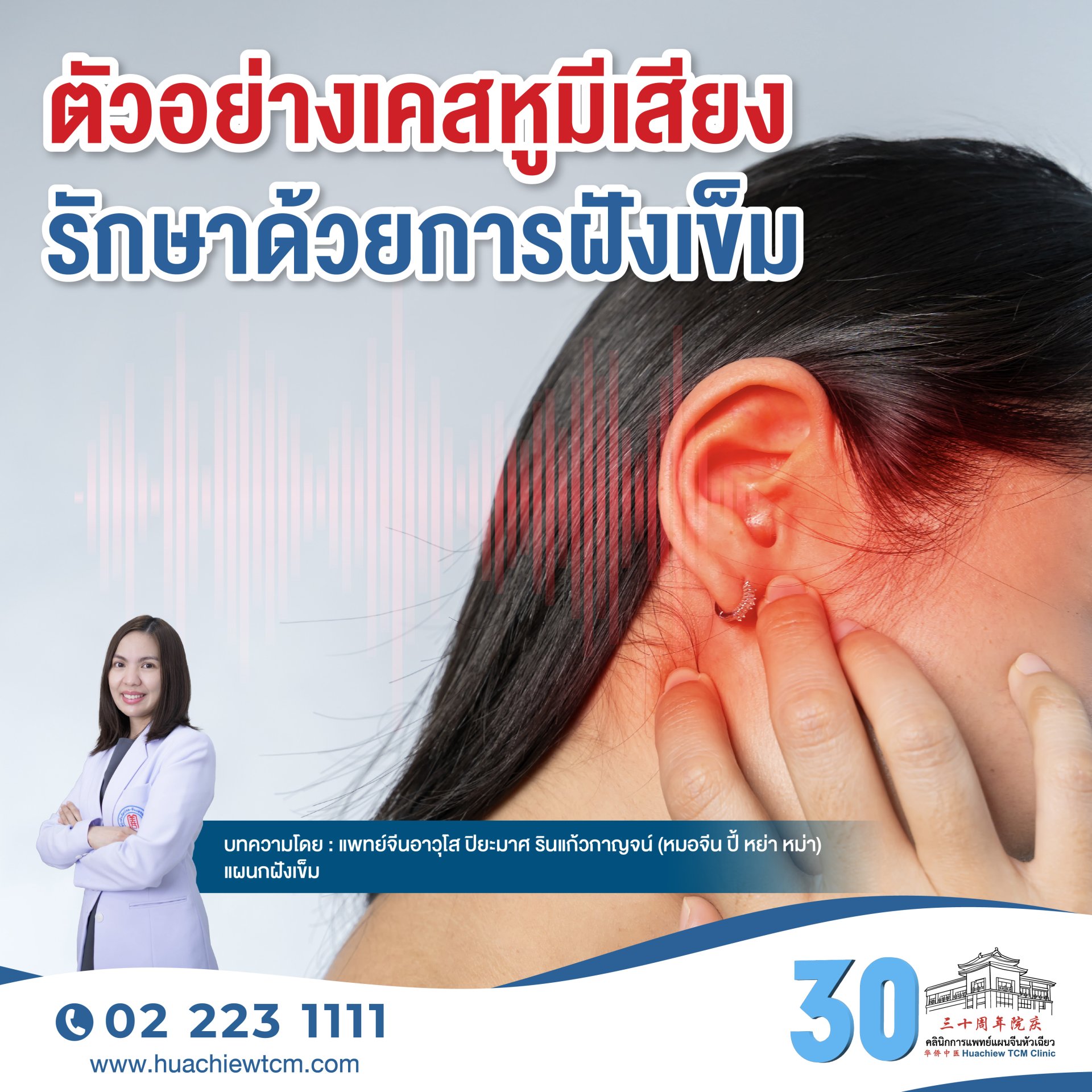 ตัวอย่างเคสหูมีเสียงรักษาด้วยการฝังเข็ม