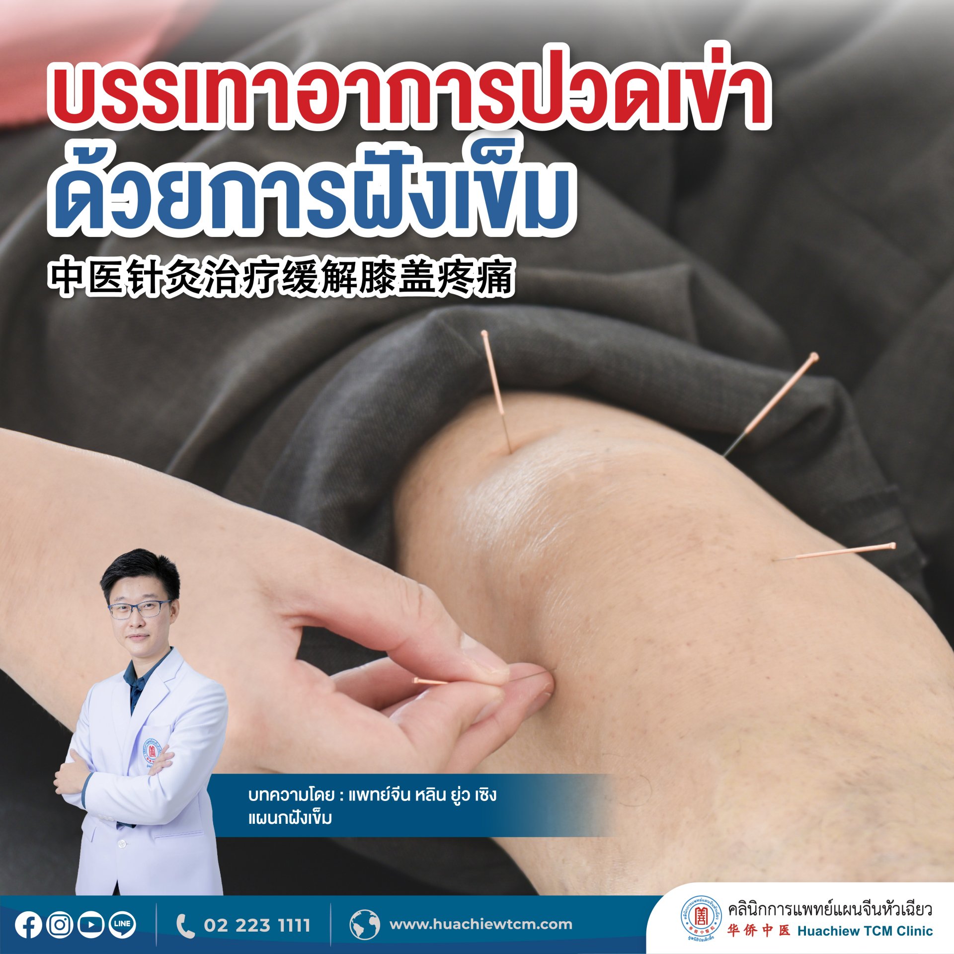 บรรเทาอาการปวดเข่าด้วยการฝังเข็ม บรรเทาอาการปวดเข่าด้วยการฝังเข็ม