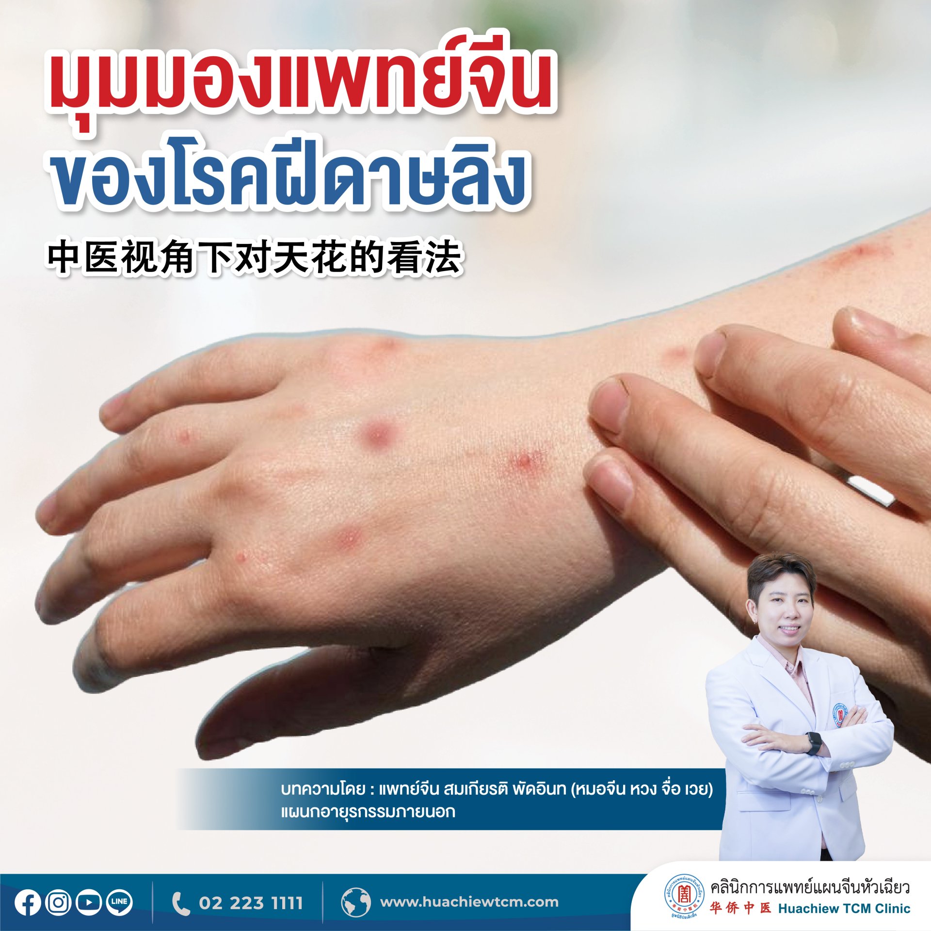 มุมมองแพทย์จีนของโรคฝีดาษลิง มุมมองแพทย์จีนของโรคฝีดาษลิง